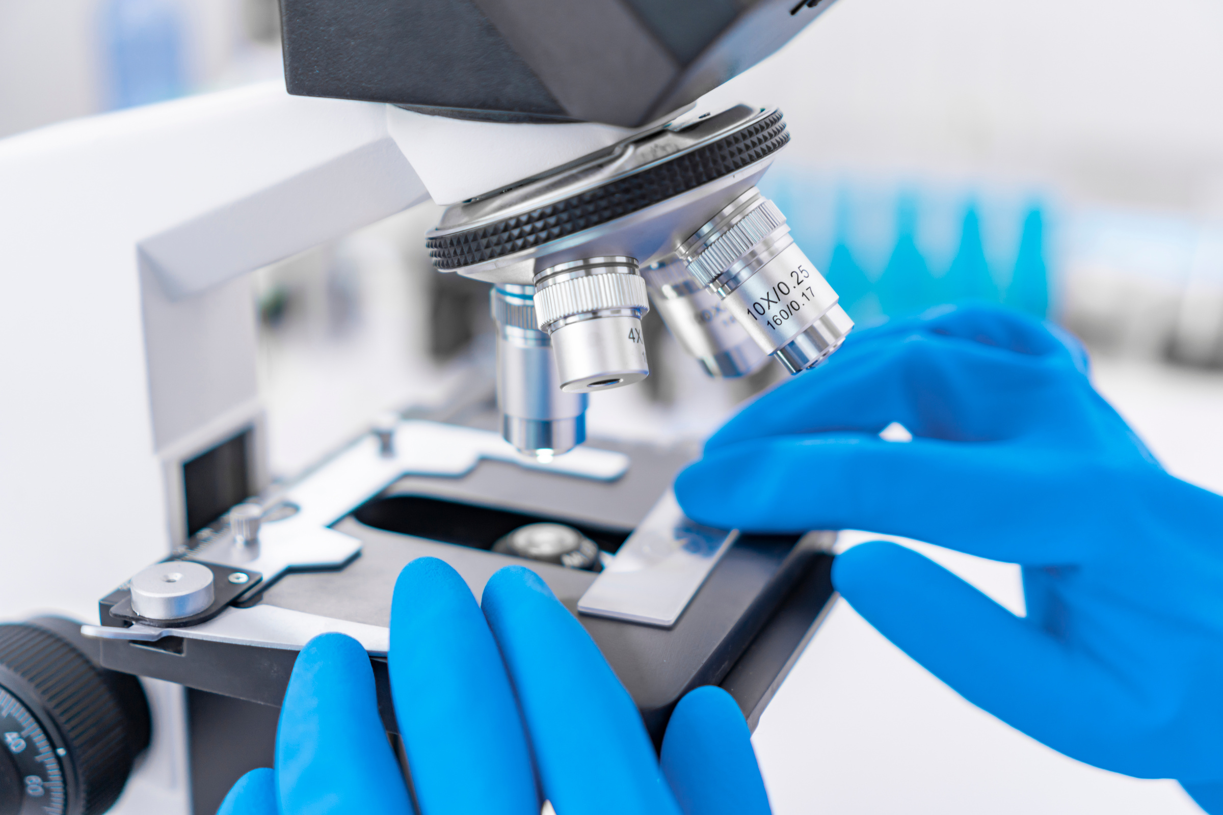 Scientist analyzing microscope slide at laboratory. Young woman technician is examining a histological sample, a biopsy in the laboratory of cancer research